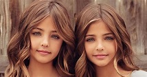 'World's Most Beautiful Twins' Are Now Famous Instagram Models ...