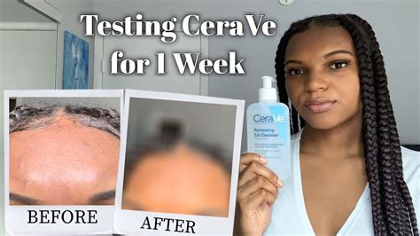 Cerave Renewing Sa Cleanser Review I Tried Cerave For 1 Week Youtube