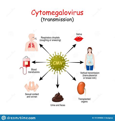 Transmission Of Cytomegalovirus Infection Stock Vector Illustration
