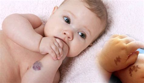 Bebeklerde Enfeksiyon Nedir Neden Olur Ve Belirtileri Nelerdir My Xxx