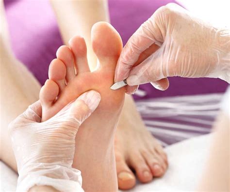What Is A Chiropodist And Do I Need To See One