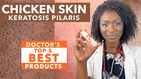 Keratosis Pilaris Chicken Skin Best Products For Black Skin Cerave