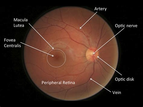 Anatomy Of The Eye Specialising In Cataract Macular