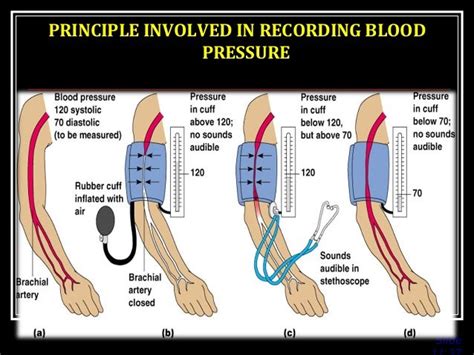 Blood Pressure