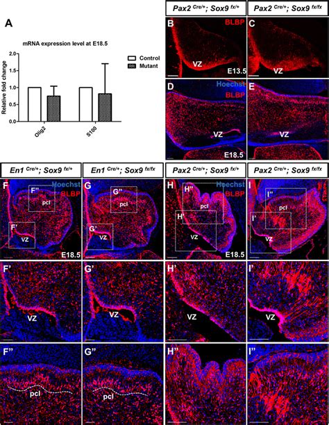 Sox9 Is Critical For Suppression Of Neurogenesis But Not Initiation Of