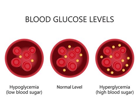 Normal Blood Glucose Levels Chart Random Blood Sugar Level