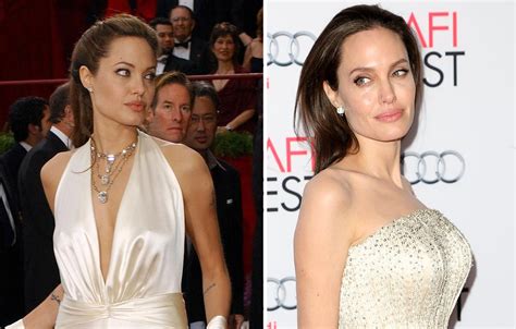 Stars Who Have Gotten Breast Implants Before After Plastic Surgery Photos