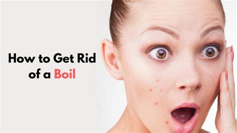 How To Get Rid Of A Boil Causes Symptoms And Home Remedies Vims