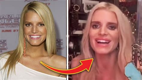 Jessica Simpsons Face Looks Wildy Different Weight Loss Or Plastic