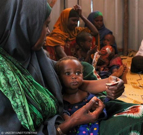 Roberto Anzanello On Twitter Rt Unicef At A Unicef Supported Clinic In Somalia 9 Month Old