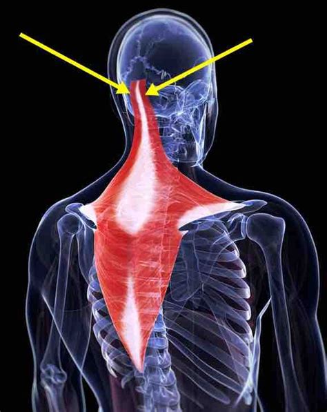 Head Pain Back Of Head More On This Topic For