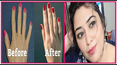 How To Make Your Hands Look 10 Years Younger In 5 Minutes Get Wrinkle