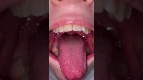 Mouth And Uvula Show Youtube