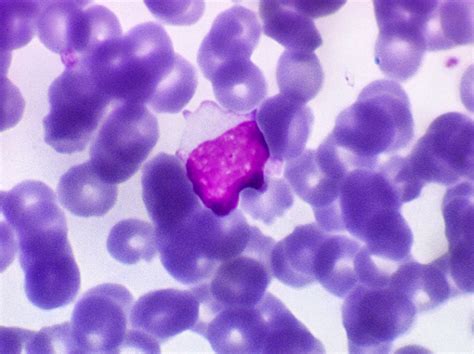 A lymphocyte is a type of white blood cell (leukocyte) in the vertebrate immune system. Physiologie des lymphocytes