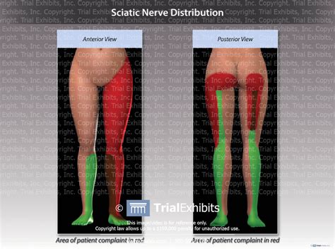 Sciatic Nerve Distribution Trialexhibits Inc