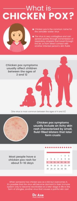Chicken Pox Symptoms How To Find Natural Relief Dr Axe