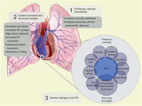 Pathobiology Of Pulmonary Arterial Hypertension And Right Ventricular