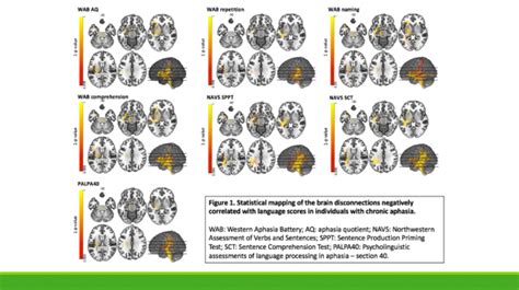 Diffusion Tensor Imaging Dti Neural Markers Mri Language