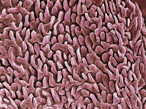 Skin Cell Sem Stock Image P7100361 Science Photo Library