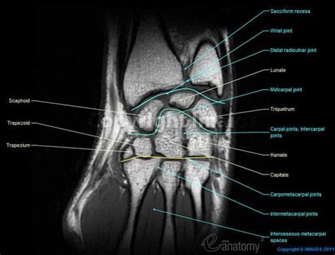 52 Best Images About Mri Anatomy On Pinterest