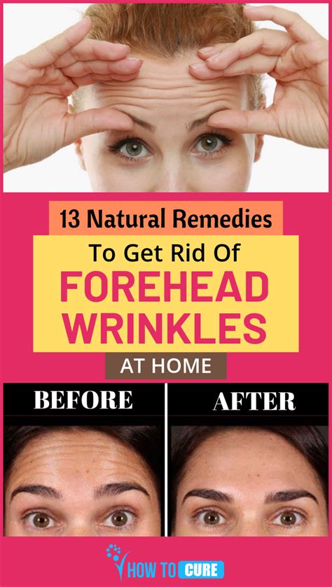 How To Remove Blackheads From Forehead Naturally Howtoremvo