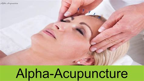 Acupuncturist In New York City Finding The Right Practitioner For Your Needs By Alpha