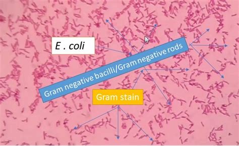 E Coli Gram Stain Introduction Principle Procedure And Result Interpret