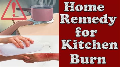 Well, here are a few remedies that can help reduce the. Home remedy for Kitchen Burn | How to treat Minor Burn ...