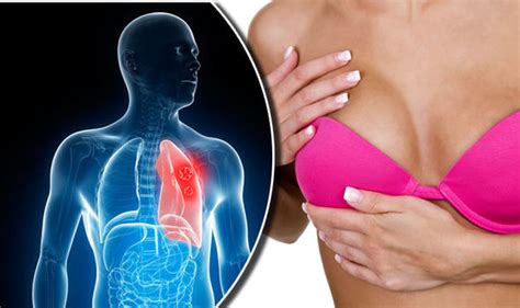 Anyone can get lung cancer, and without a screening test for everyone, an awareness of these symptoms is important in detecting the disease as early as. Lung cancer symptoms: Coughing up blood sign of most ...