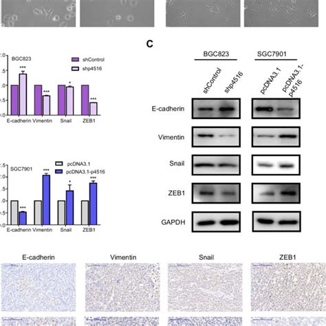 Lncrna P4516 Involved Emt In Gc Cells A Cell Morphology Changes In