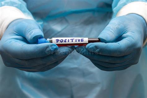 A Doctor Shows A Test Tube With A Positive Results Stock Image Image