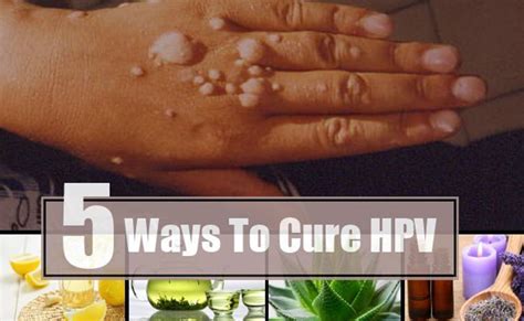 5 Home Remedies To Treat Hpv Naturally Best Herbal Health