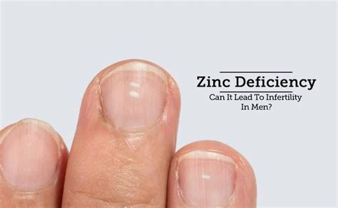 Everything About Zinc Deficiency Symptoms Risks Greenbhl