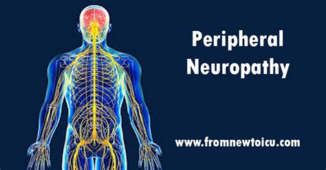 Peripheral Neuropathy — From New To Icu