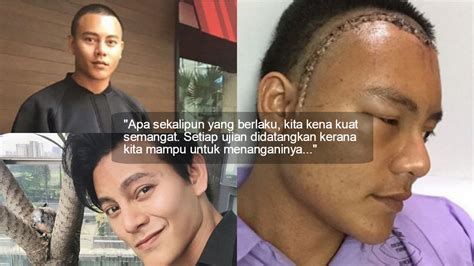 Mengatasi sakit kepala dengan biji alpukat jika penyebab sakit kepala anda disebabkan oleh demam, anda bisa membuat pengompres alami dari biji alpukat. Pernah Diuji Dengan Tumor Di Kepala, Nasihat Nazim Othman ...