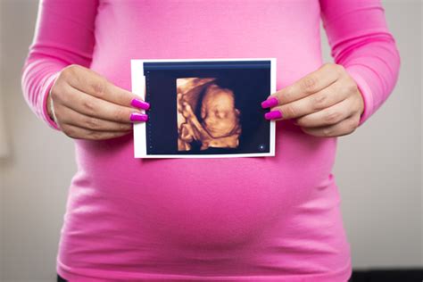 Three Reasons You Should Consider Getting An Elective Ultrasound Baby