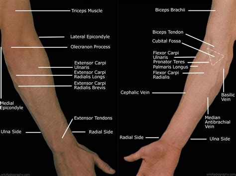 Forearm Pain Relief Cause And Treatment Deep Recovery