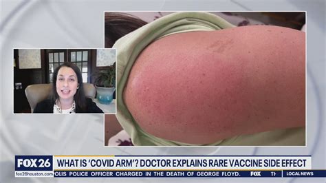 Delayed Skin Reactions After Taking The Covid 19 Vaccine