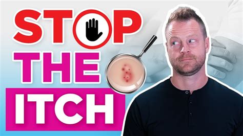 Heal Eczema Naturally Youtube