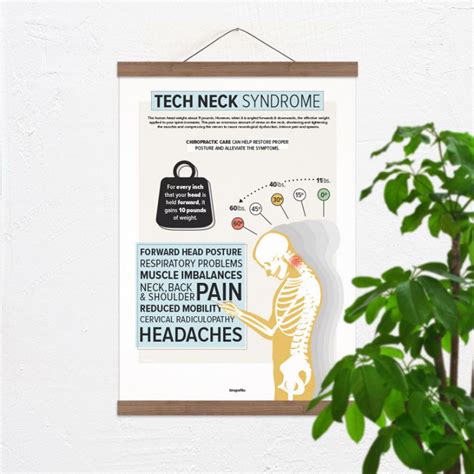 Tech Neck Syndrome Poster Text Neck Syndrome Poster