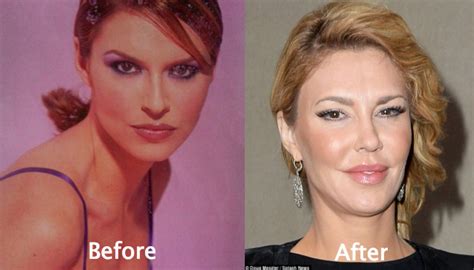 Brandi Glanville Plastic Surgery Before And After Photos