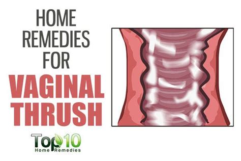 Home Remedies For Vaginal Thrush Top 10 Home Remedies
