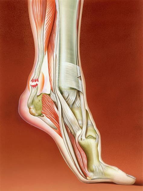 Tendons tendons are fibrous cords, similar to a rope, and are made of collagen. Achilles Tendon Rupture Photograph by John Bavosi