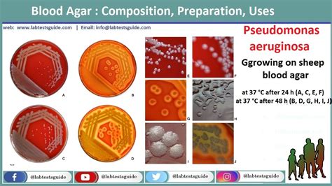 Blood Agar Composition Preparation Uses Lab Tests Guide