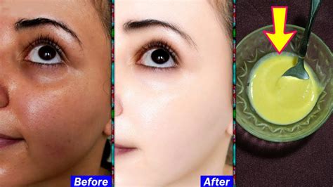 Get Fair Clear And Glowing Skin In Just 20 Minutes Fast Skin Whitening