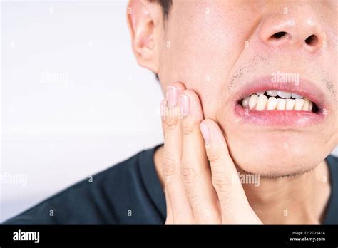 Man Suffering From Toothache Hand Touching Wisdom Tooth Dental