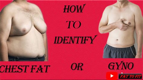 How To Know If You Have Gynecomastia How To Identify Chest Fat Or Gynecomastiachestfatgyno