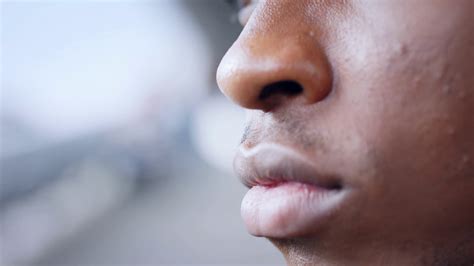 Extreme Close Up Of Frustrated Young Black Man Outdoors Black Lives