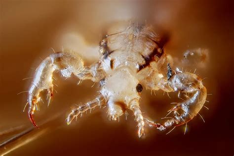 Head Lice Under Microscope