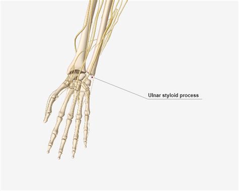 Ulnar Fractures Of The Wrist Ulnar Styloid Fracture Off